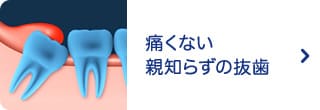 痛くない親知らずの抜歯