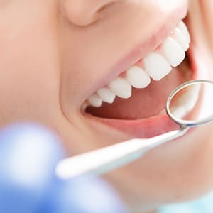 予防歯科・歯科検診